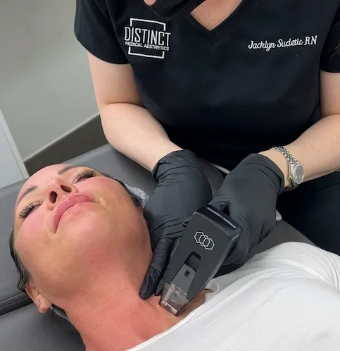 Nurse Jacklyn performing a Morpheus8 Treatment for Neck Rejuvenation