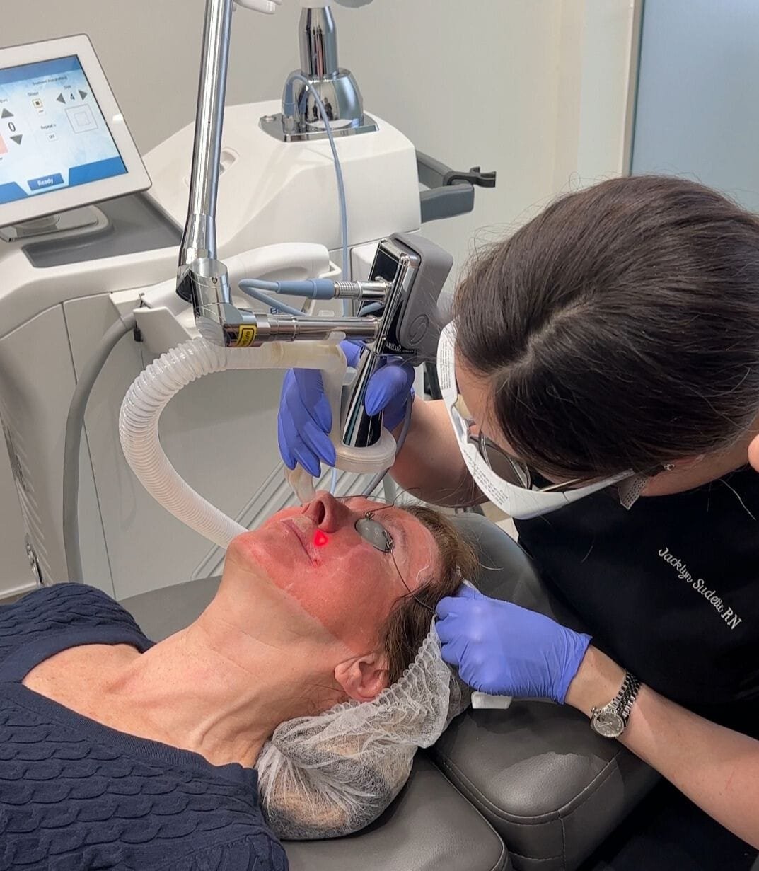 Nurse Jacklyn Performing Erbium Ablative resurfacing with a Sciton Contour TRL on a patient