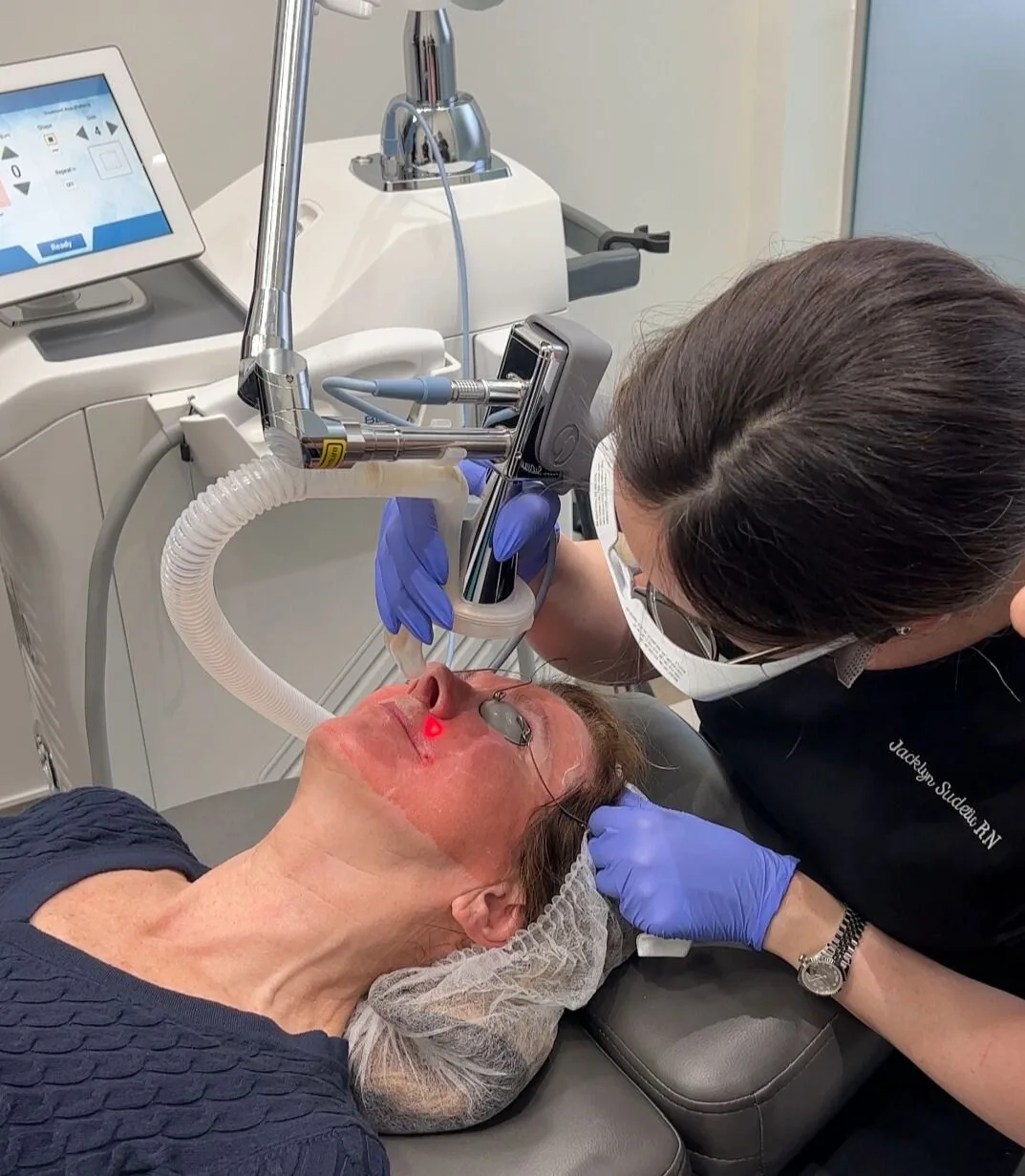 Nurse Jacklyn Performing Erbium Ablative resurfacing with a Sciton Contour TRL on a patient