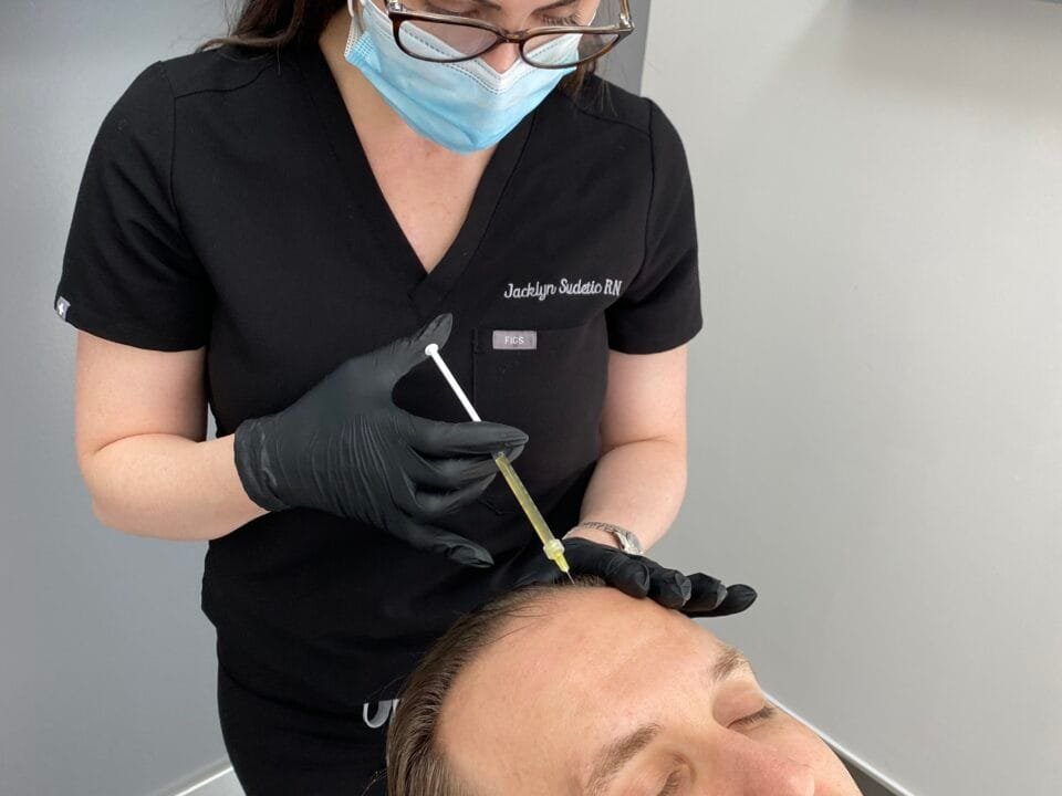 Nurse Jacklyn a PRF treatment on a male patient for hair restoration
