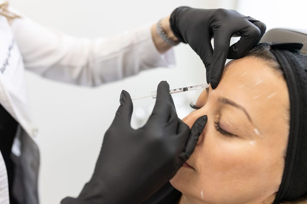 Close-up of a cosmetic neuromodulator injection being performed during a Botox appointment.